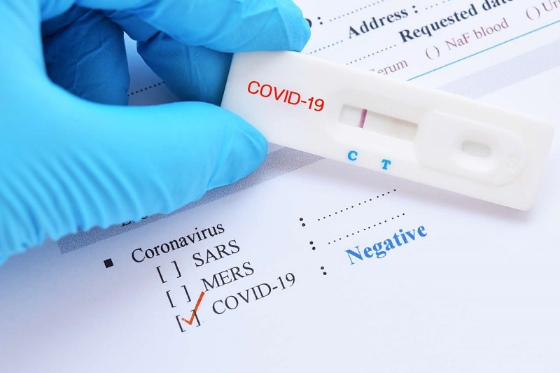 pcr-test-covid-resultat-negatif